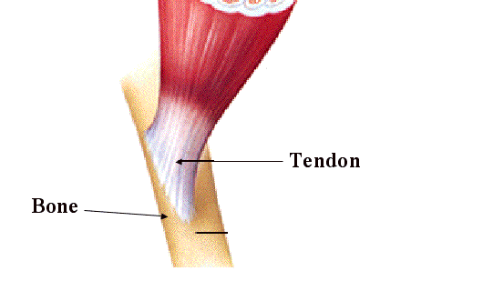 focus sur la tendinite